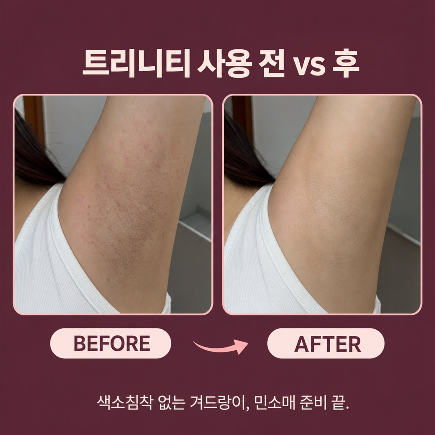 TRINITY 2in1  저자극 바디 트리머